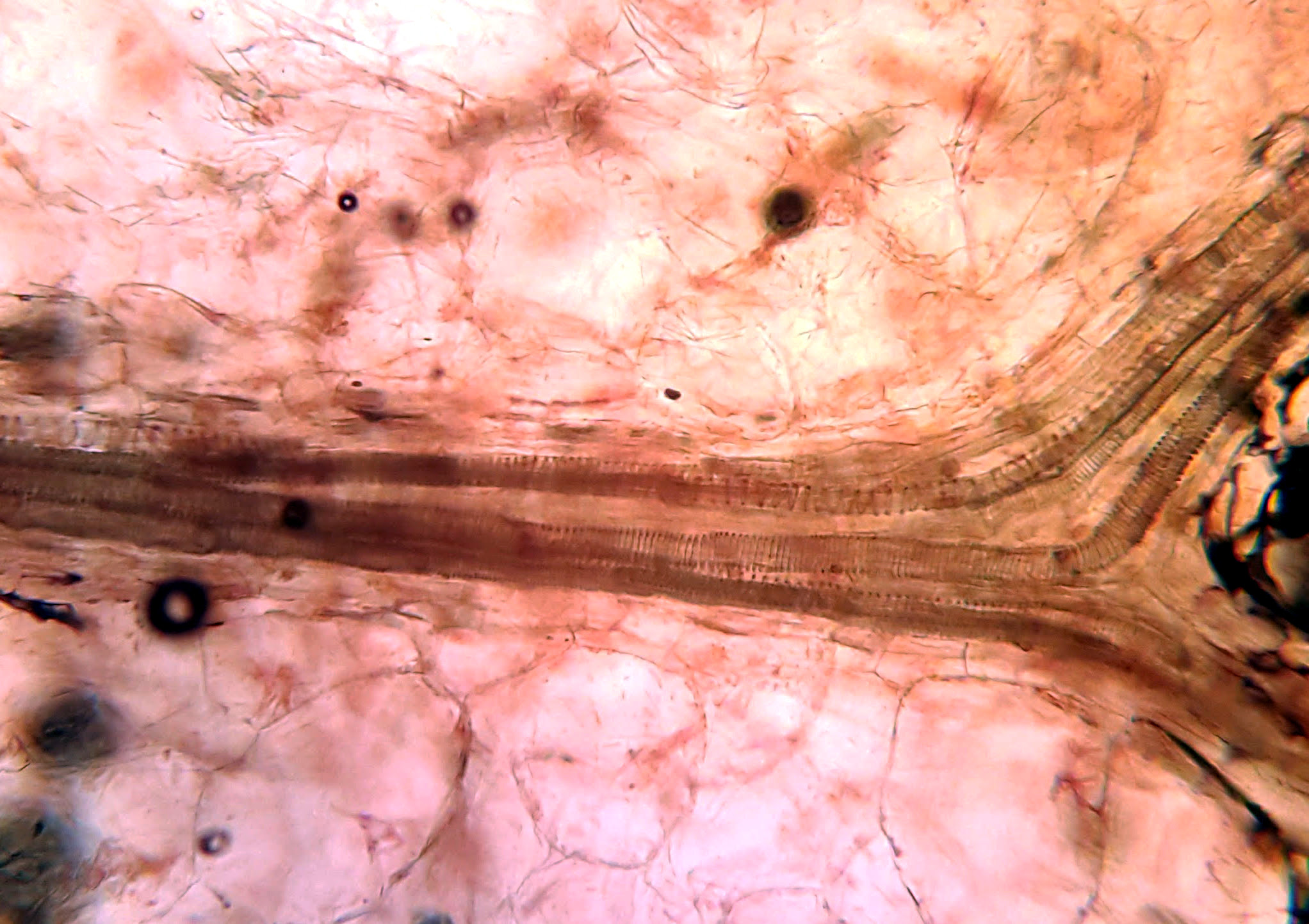 Мякоть Арбуза Обыкновенного в микроскоп