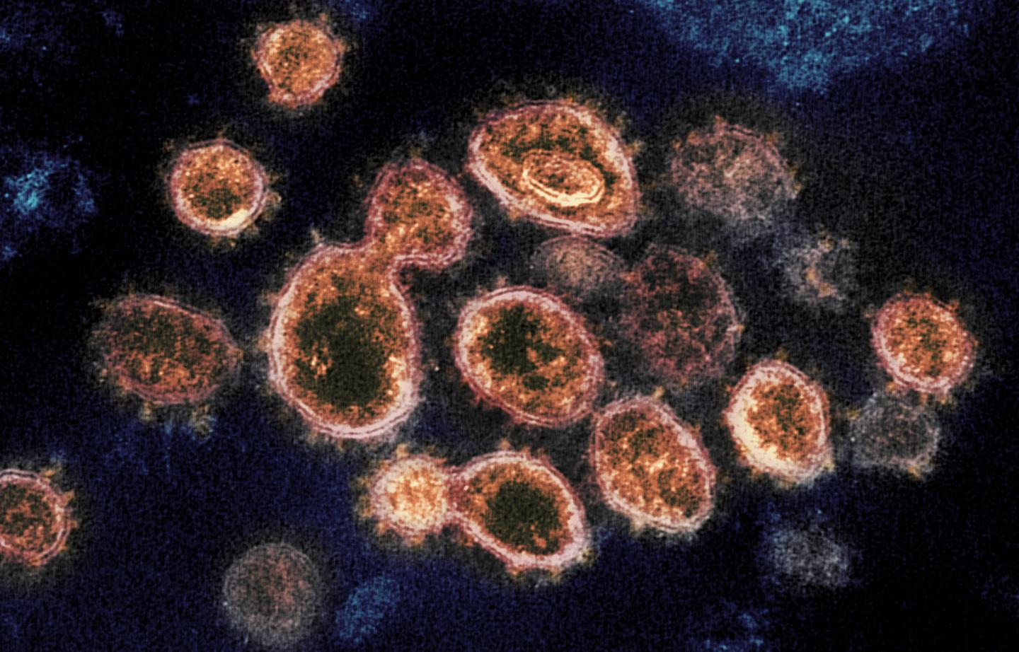 Коронавирус COVID-19 под микроскопом